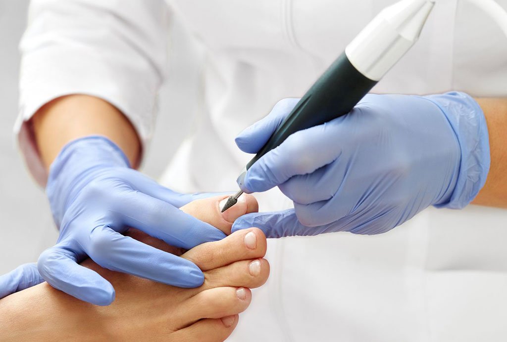 Especialista en tratamientos del pie con láser en monterrey