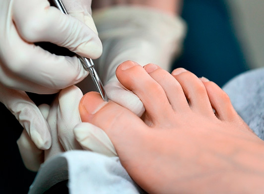 Médico especialista en enfermedades del pie monterrey